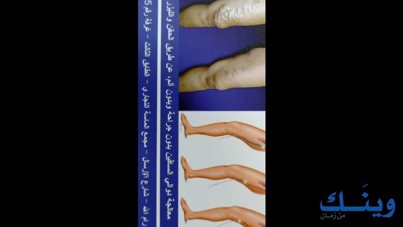 الدكتور مراد ابراهيم غنايم