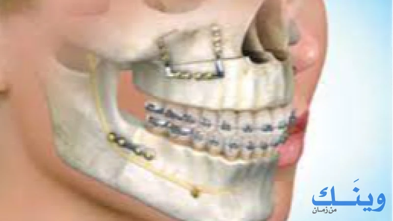 مركز الدكتور رائد الجلاد لجراحة الوجه والفكين