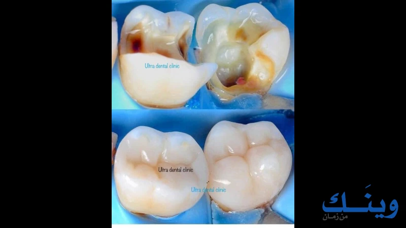 Ultra dental clinic