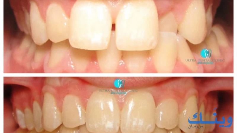 Ultra dental clinic