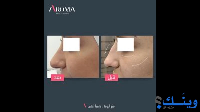عيادة تجميل اروما