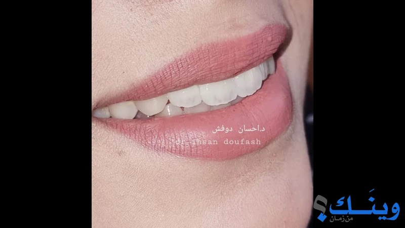 عيادة د. اسماء دوفش والدكتور احسان دوفش
