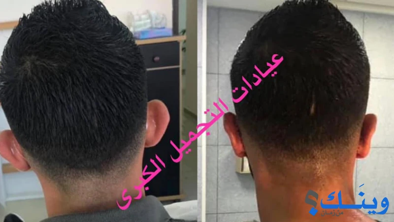 عيادات التجميل الكبرى