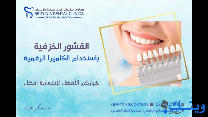 مركز بيتونيا الحديث لطب الاسنان