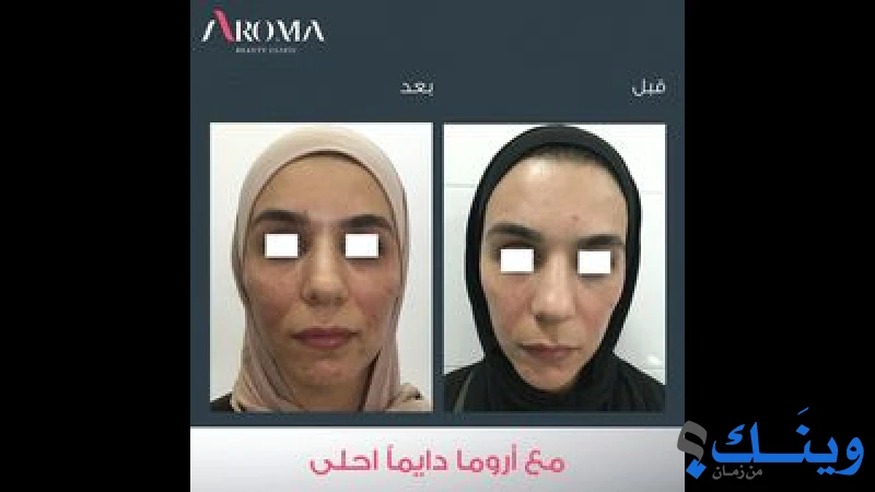 عيادة تجميل اروما