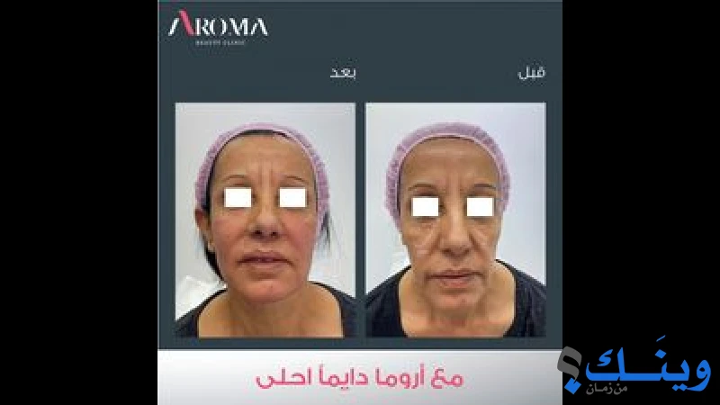عيادة تجميل اروما