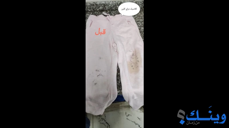 كلاسيك دراي كلين