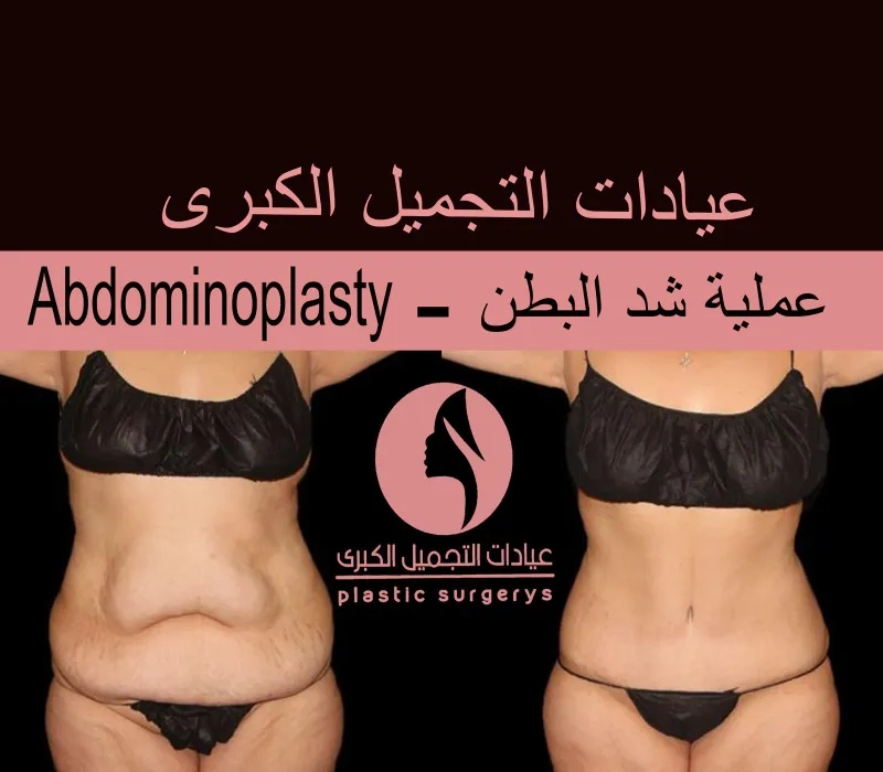 عيادات التجميل الكبرى