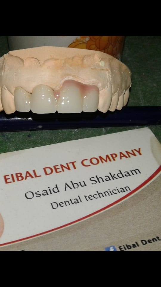 عيبال للاسنان