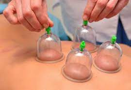 مركز العودة للحجامة والاعشاب